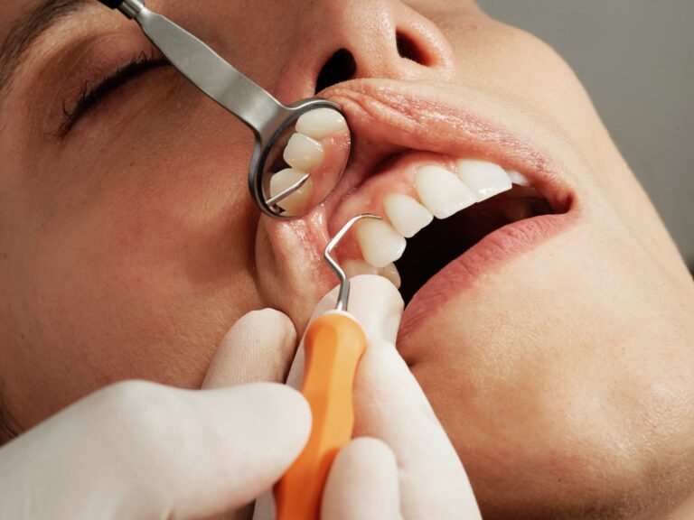 prevencion-periodontitis