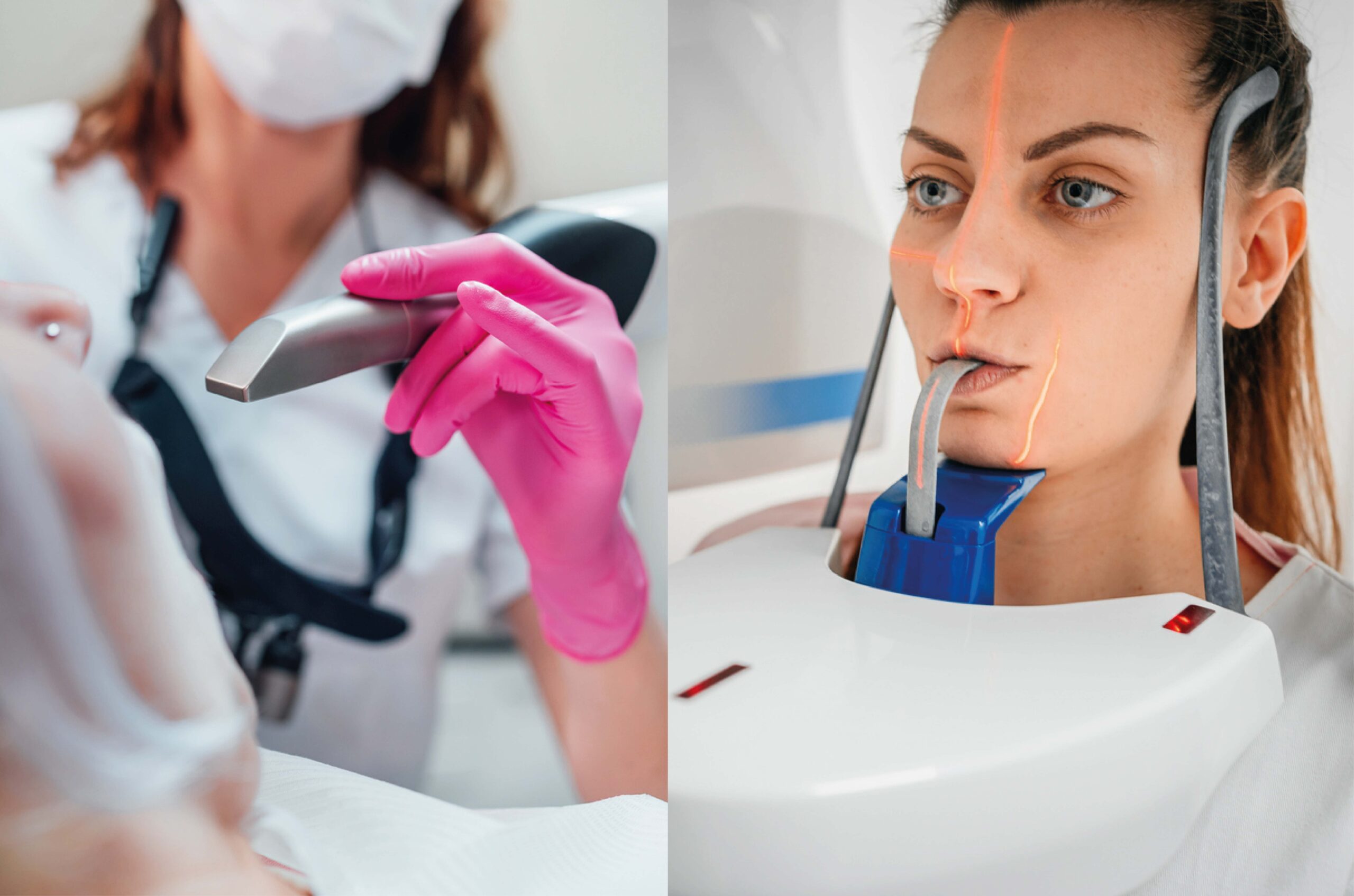 escáner intraoral vs. impresión tradicional
